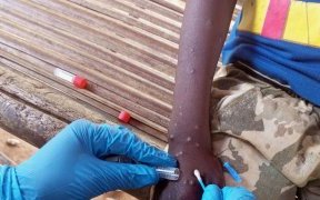 Mpox en Afrique : les enfants particulièrement menacés par la nouvelle variante